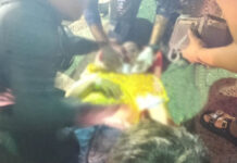 Choque entre carro y moto dejó a una mujer herida en el puente de El Yucal