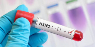 Epidemiólogo alerta tras confirmarse caso de H1N1 en su nieto de 1 año en Santa Marta