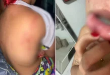 Mujer denunció a su expareja por presunta agresión física en Santa Marta